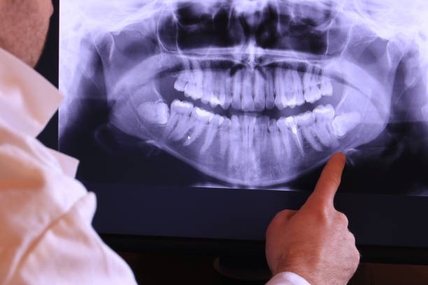 Best Emergency Tooth Extraction in Whiteland, IN
