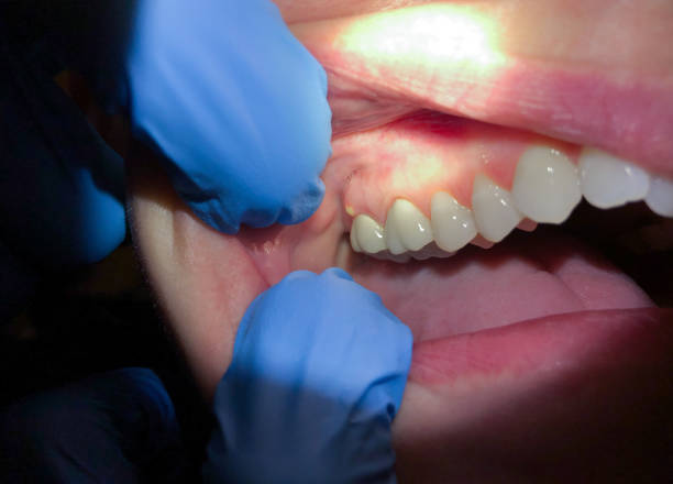 Best Emergency Treatment for Toothache in Whiteland, IN