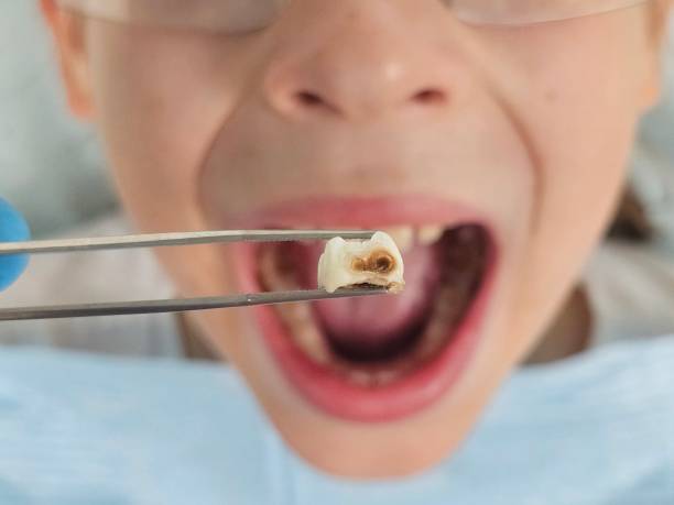 Best Same-Day Emergency Dentist in Whiteland, IN
